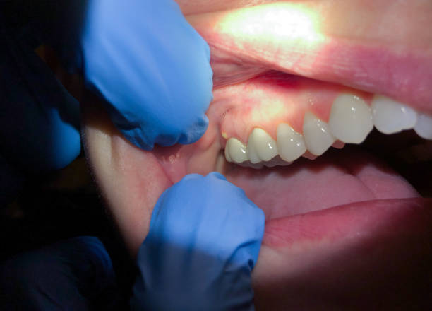 Best Emergency Treatment for Toothache in Sheridan, OR